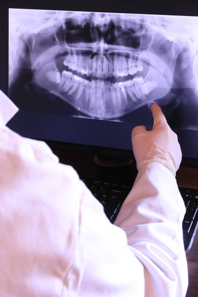 Best Emergency Dental Extractions in Morgantown, KY